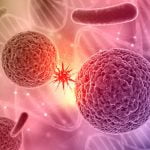 cáncer en albacete